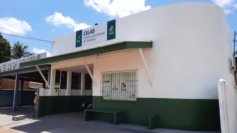 Centro Laboratorial de Santana oferta mais de 70 exames. Veja o horário de atendimento